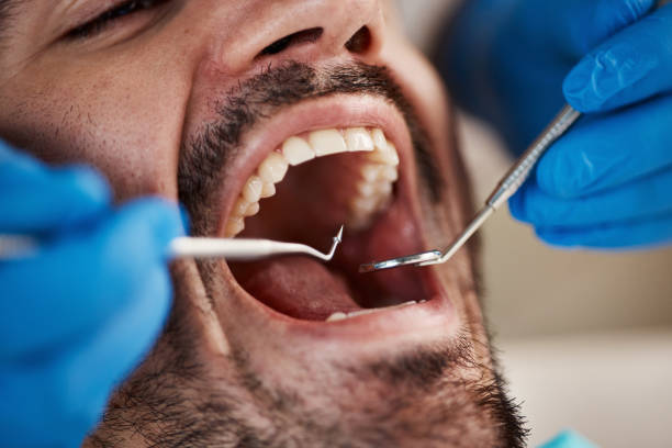 Best Cosmetic Dentistry  in Wacousta, MI